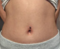 /album/piercing/778401225-122137191531352473-2536738191654058449-n-jpg/
